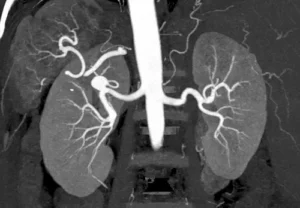 kt-angiografiya-4