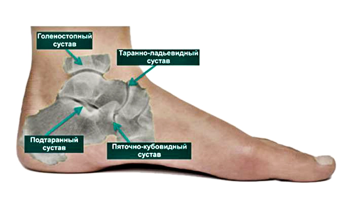 osteoartroz6