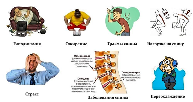 причины остеохондроза